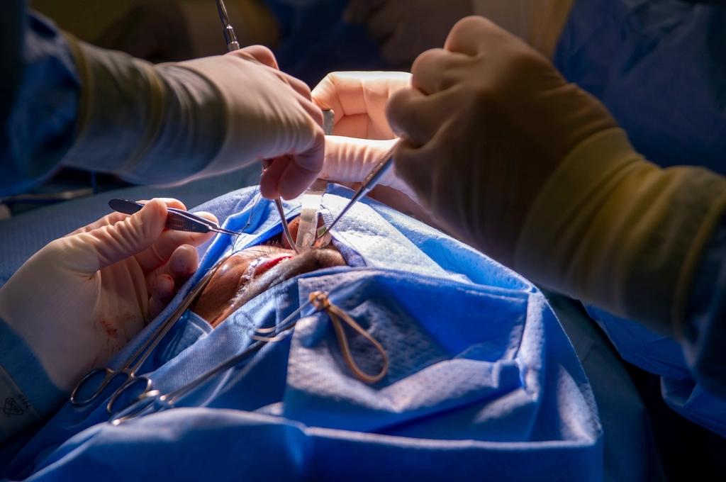 Clinical team at work in a hospital theatre