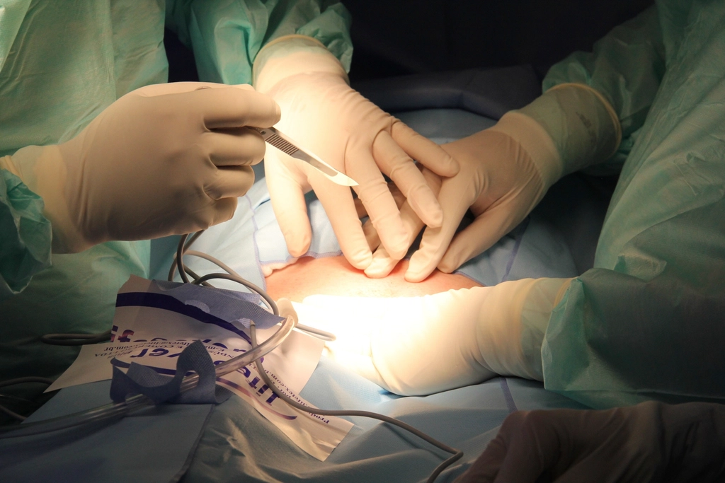 Surgical team performing an operation in a hospital theatre